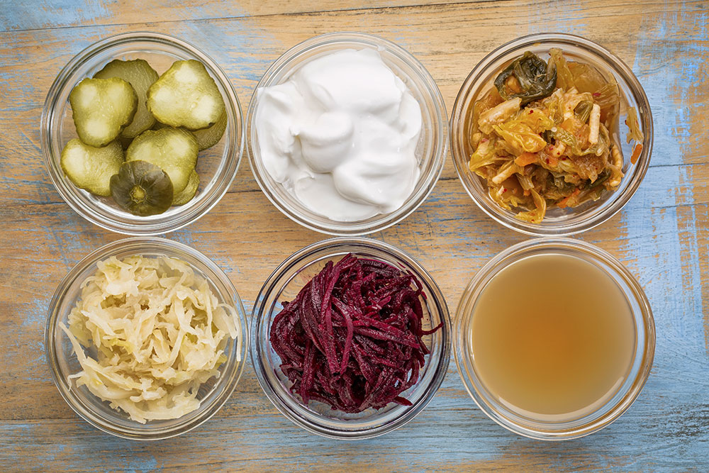 Why Fermented Foods Are Your Friend