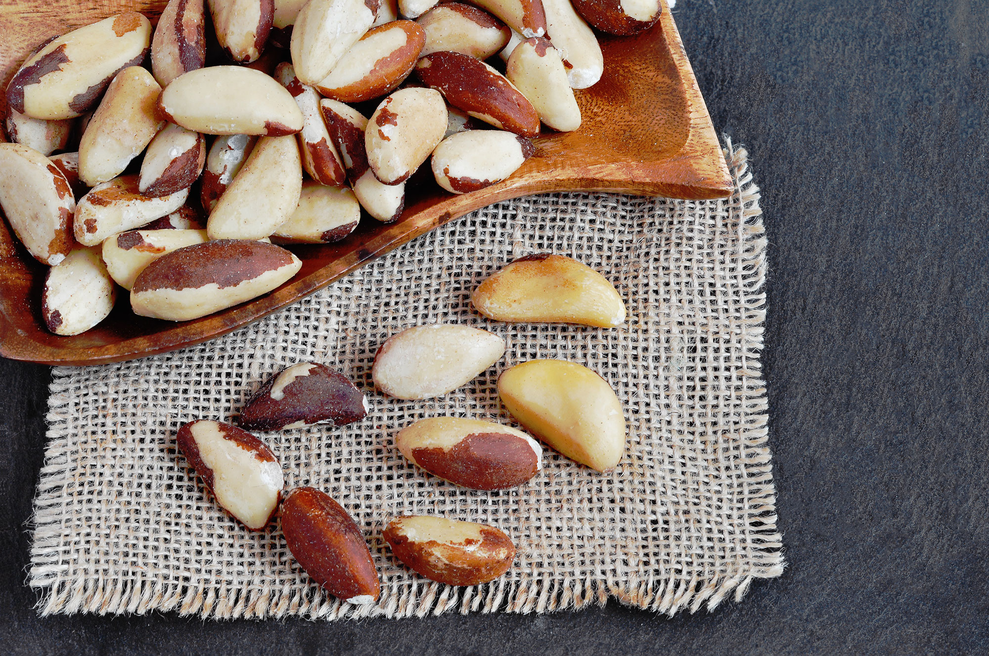 brazil nuts, foods high in methionine